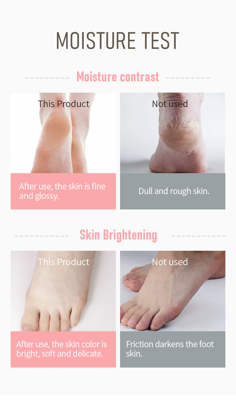 Urea Foot Cream (6)