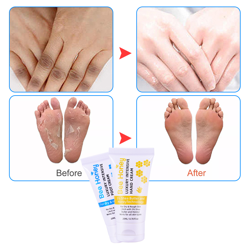 20ml Shea Butter Hand Repair Cream for dry, tough skin that repairs and keeps skin soft By LIRAINHAN