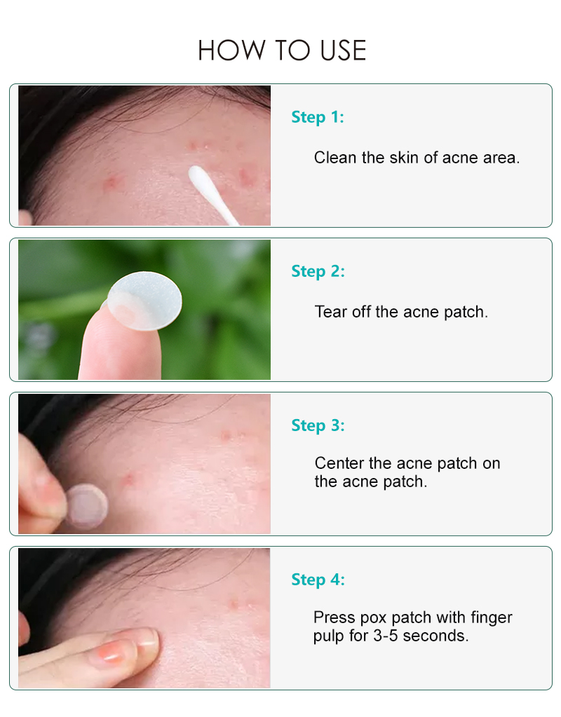 Pimple Patches (2)