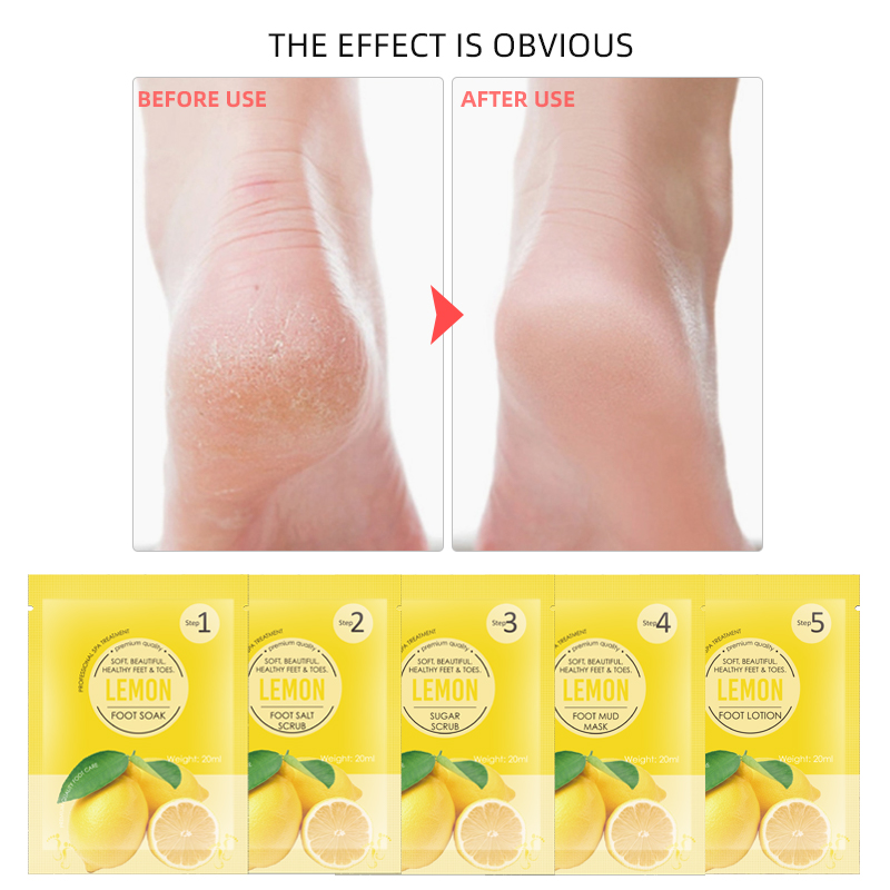 OEM ODM 5 Steps Lemon Foot Jelly&Salt Set,Foot Soak+Sugar Scrub+Foot Salt Scrub+Foot Mask+Foot Cream