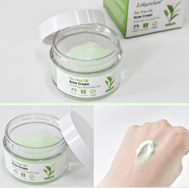 OEM ODM OBM Tea tree anti-acne and oil-control facial cream