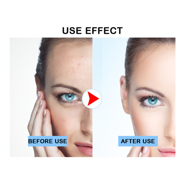 Private Label Hydrolyzed oat protein VE Explosive Essence Sets For Moisturizing Cleanser+Day Cream+Night Cream