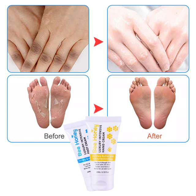 20ml Shea Butter Hand Repair Cream for dry, tough skin that repairs and keeps skin soft By LIRAINHAN