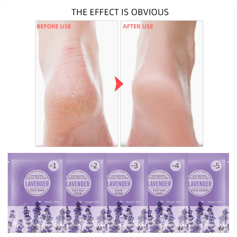 OEM ODM 5 Steps Lavender Foot Jelly&Salt Set,Foot Soak+Sugar Scrub+Foot Salt Scrub+Foot Mask+Foot Cream
