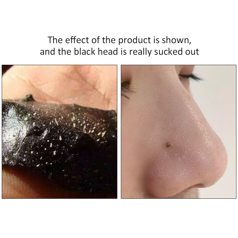 Factory Custom Charcoal, Deep Cleansing Pore Strips, Nose Strips for Blackhead Removal on Oily Skin
