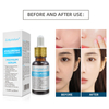 Factory Custom Deep Hydration Moisturize, Plump, Firm, and Smooth Hyaluronic Acid Serum for Youthful Skin