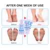 Factory Custom Foot Pedicure Foot Spa Callus Remover Scrub Kit With Foot Peeling Serum And Moisturizing Urea Cream
