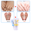 Travel Mini 20ml Urea Foot Cream For Foot Moisturizer Dead Skin Remover Toenail Softener By LIRAINHAN