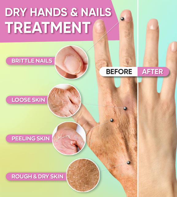  Milk Moisturizing Hand Mask For Cracked, Rough Hands,Remove Dead Skin By LIRAINHAN