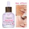 Custom Rose Petals Bright Anti Wrinkle Face Serum