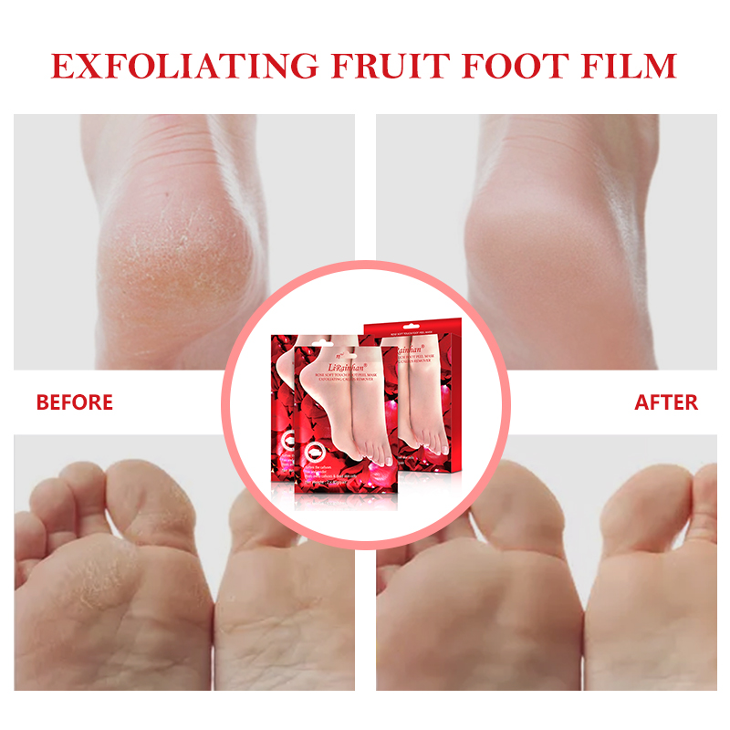 Rose Exfoliating Foot Mask for Dry, Cracked Feet, Callus, Dead Skin Remover By LIRAINHAN